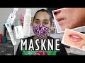 GRANOS POR USAR MASCARILLA MASKNE | RECOMENDACIONES PARA CUIDAR LA PIEL CON MASCARILLA| CARLA CALVO