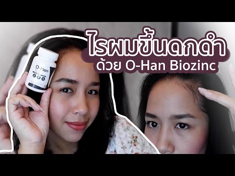 Zinc (ซิงค์ วิตามินสังกะสี) ตัวเด็ด ลดผมร่วง ไรผมงอกใหม่ รากผมแข็งแรง O-Han Bio zinc