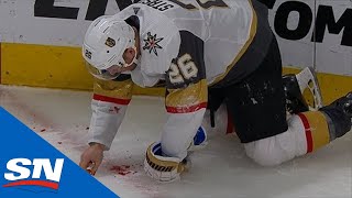 Keith Yandle loses nine teeth after being hit in the mouth with a puck
