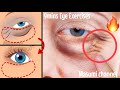 9mins Big Eye Massage! (Fast Results) Lift Eye Bags, Droopy Eyelids, Dark Circles Under Eyes