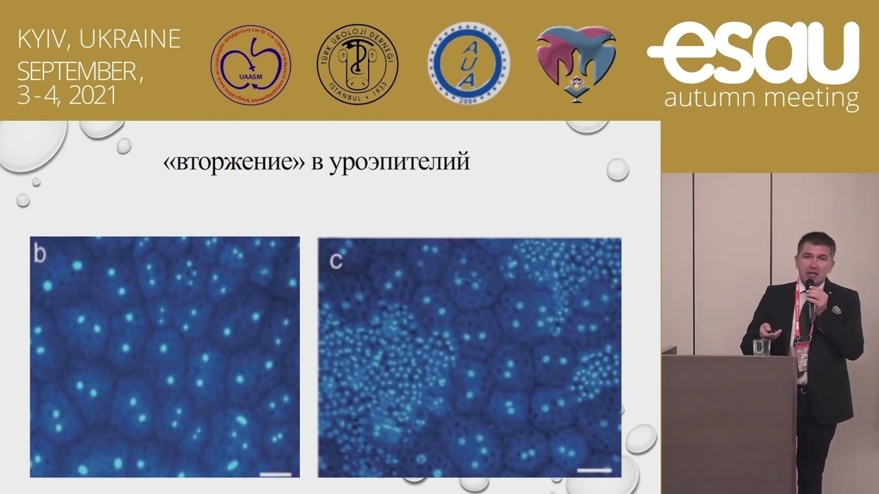 D-Маноза Новеко - підтримка сечовидільної системи, 20 стиків