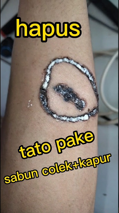 hapus tato permanen pake kapur sabu colok #hapustatopermanen #hapustato #videoshort #shorts