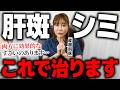 冬はコレ 肝斑 シミを最速で治療する方法を教えます 皮膚科医が徹底解説 冬はコレ 肝斑 シミを最速で治療する方法を教えます 皮膚科医が徹底解説