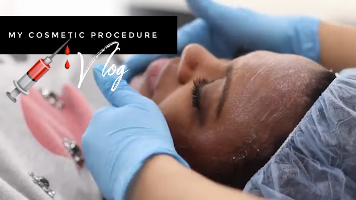 My Cosmetic Procedure with Dr  Jing Jing