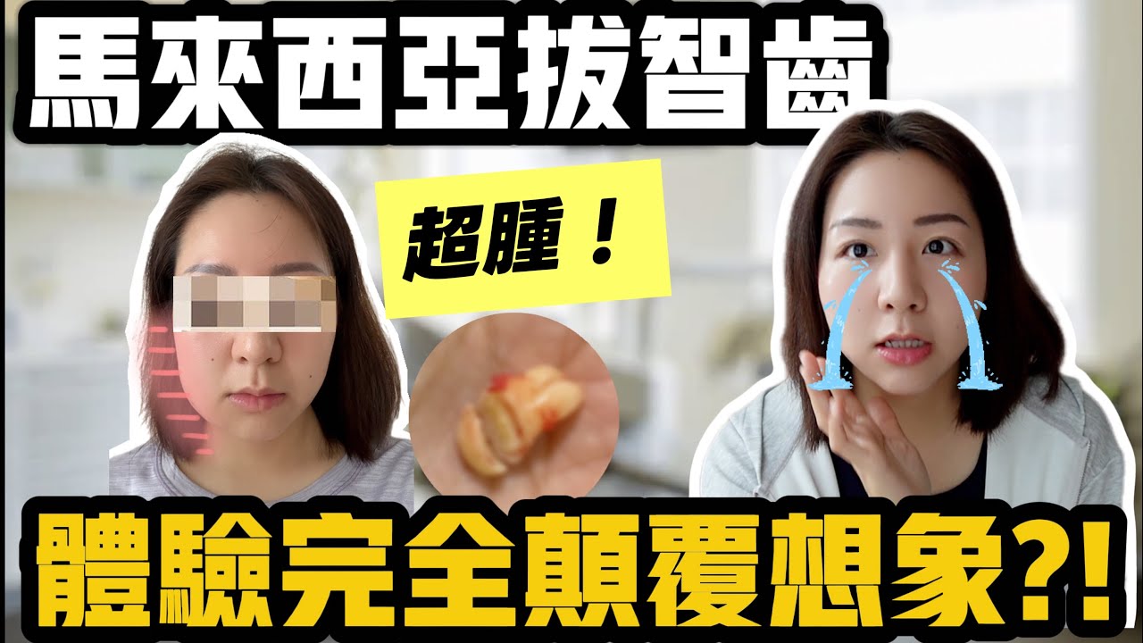 台灣人在馬來西亞拔智齒，體驗完全顛覆想像…費用 RMXXXX？！