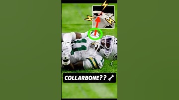 Doctor explains Jayden Reed’s GRUESOME Broken Collarbone #packers #injury #education #science