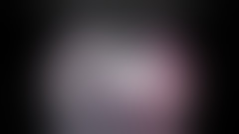 Choroid Plexus Coagulation and Plexectomy for hydrocephalus in children