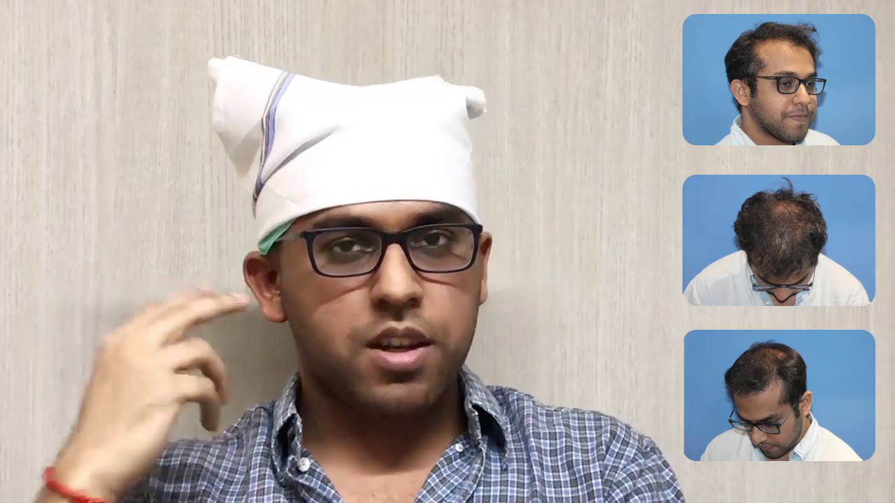 Hair Transplant Surgery Eugenix Hair Transplant Sciences YouTube