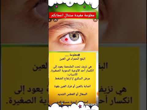 أسباب البقع الحمراء التي تظهر فجأة بالعين
