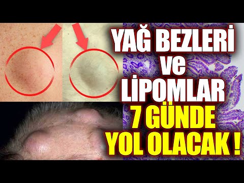 Video: Aktif kömür nasıl temizlenir