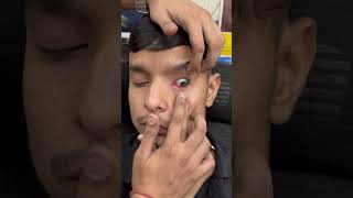 Lens kese lagate hai #opticalillussion #eyedoctor #opticalvision #eyedoctor #contectlens #shortsfeed