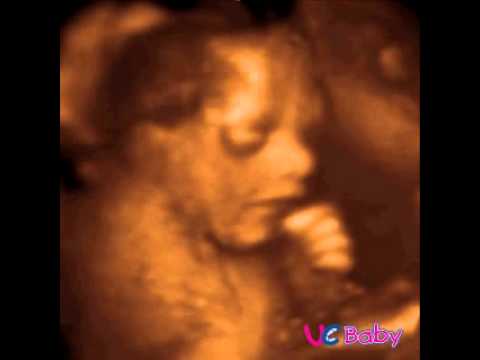 UC BABY - Example 4D ultrasound scan #43