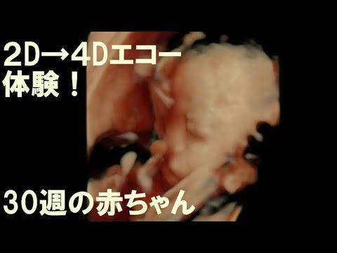 ４dエコー体験 8ヶ月30週の赤ちゃんはこんな感じ Youtube