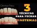 🛑DIASTEMAS: 3 TÉCNICAS PARA FECHAMENTOS DE ESPAÇOS ✍👌