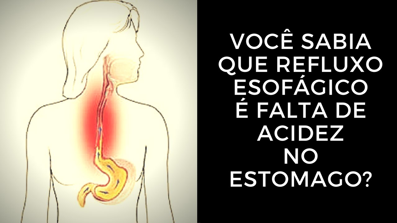 sintomas da acidez no estomago