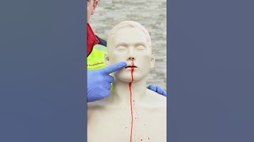 First Aid for Nosebleeds 🩸🤕 #ambulance #firstaid #paramedic #hospital #emergency #nurse