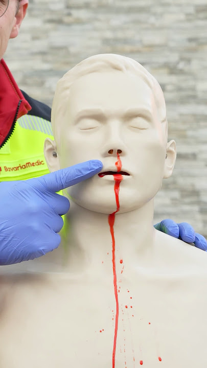 First Aid for Nosebleeds 🩸🤕 #ambulance #firstaid #paramedic #hospital #emergency #nurse