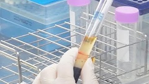 The isolation and preculture method of PBMCs for human iPS cell establishment