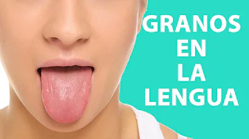 ¿Cómo se llama un grano en la lengua?