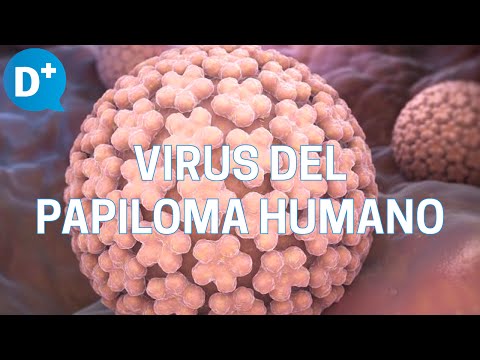 Video: ¿Podría tener el virus del papiloma humano?