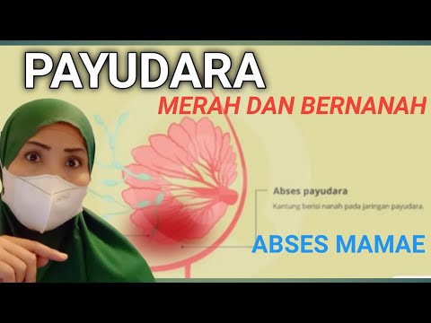 Video: Mengapa hematit berat?