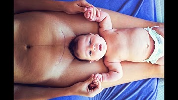 Cesarean Delivery CPT code - simplify medical coding