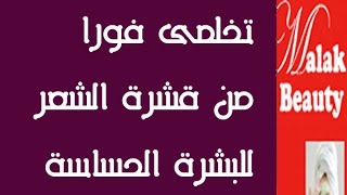 تخاصى من قشرة الشعر فورا/علاج قشرة الشعر للبشرة الحساسة والنتائج فوريه/وصفات لقشرة الشعر مع ملك