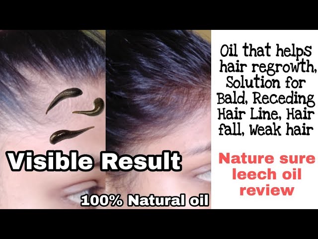 Leech Oil for baldness,hair fall, hair regrowth,Thin hair and various hair  problems-Nature Sure - YouTube
