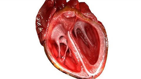 Game play | How to make Heart in infinite craft @cheatlittlealchemy