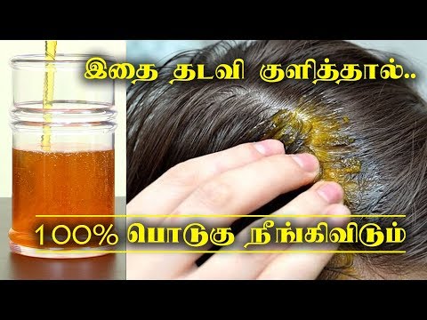 Ayurvedic treatment for dandruff in tamil using home remedies, naturally (podugu poga tips). prepare this anti-dandruff oil at and remove ju...
