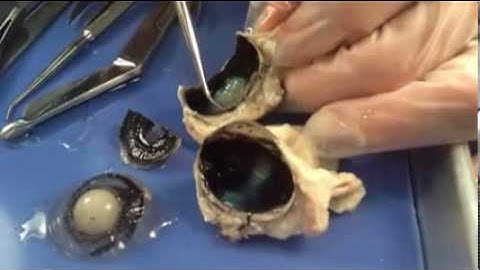 Prof. Wilson sheep eye dissection.  The best sheep eye dissection