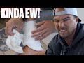 REMOVING BANDAGES AFTER SURGERY | EW!