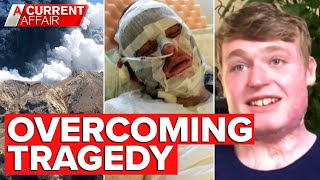 White Island volcano survivor's lesson in resilience | A Current Affair