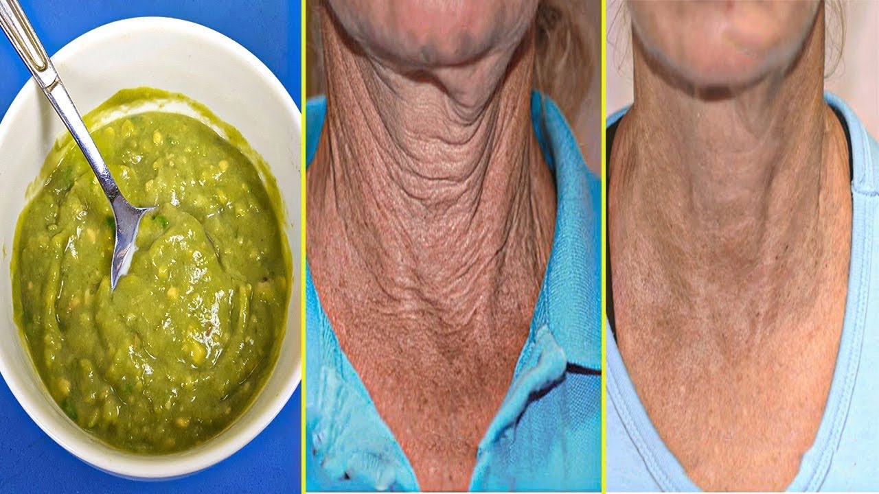 J’ai Utilisé Ce Masque - Enlève Les Rides Profondes Du Cou Et Obtient Une Peau Douce