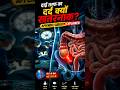 Operation Theater Appendix Surgery | Right Side Stomach Pain Explained #facts #Otexplore