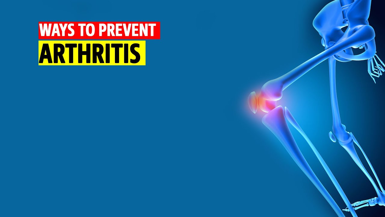 Ways to prevent Arthritis YouTube
