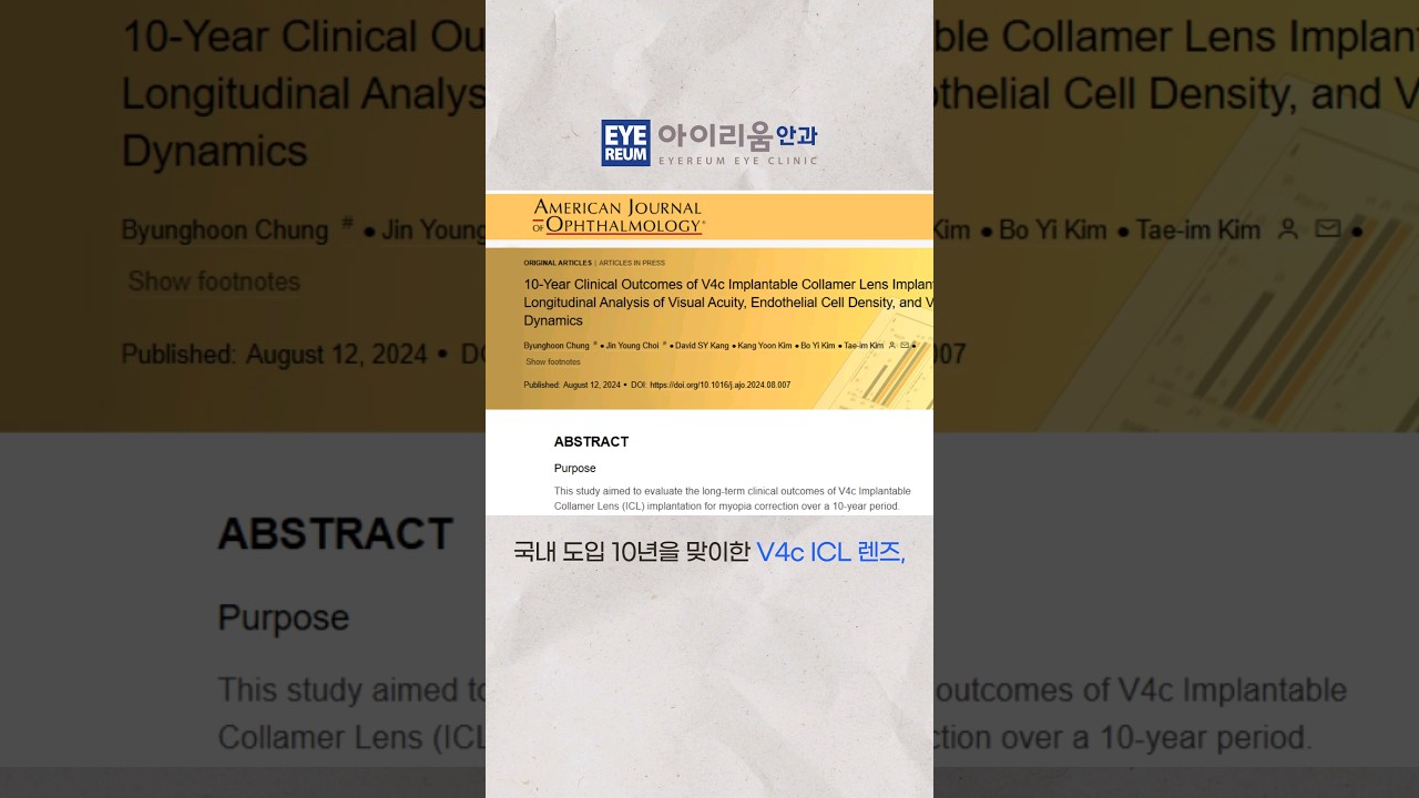 [Phòng khám mắt Eyerium] #Thấu_kính_ICL #V4c #Phẫu_thuật_cấy_ghép_thấu_kính_ICL Kết quả lâm sàng trong 10 năm, được đăng trên tạp chí AJO