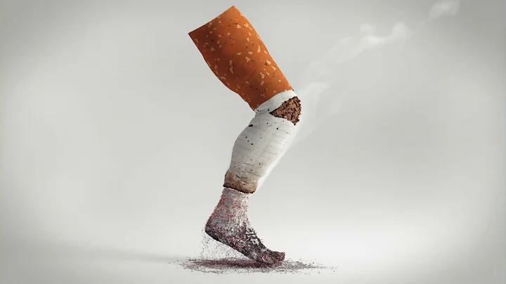 Symptoms of Vascular Disease | Burning leg pain