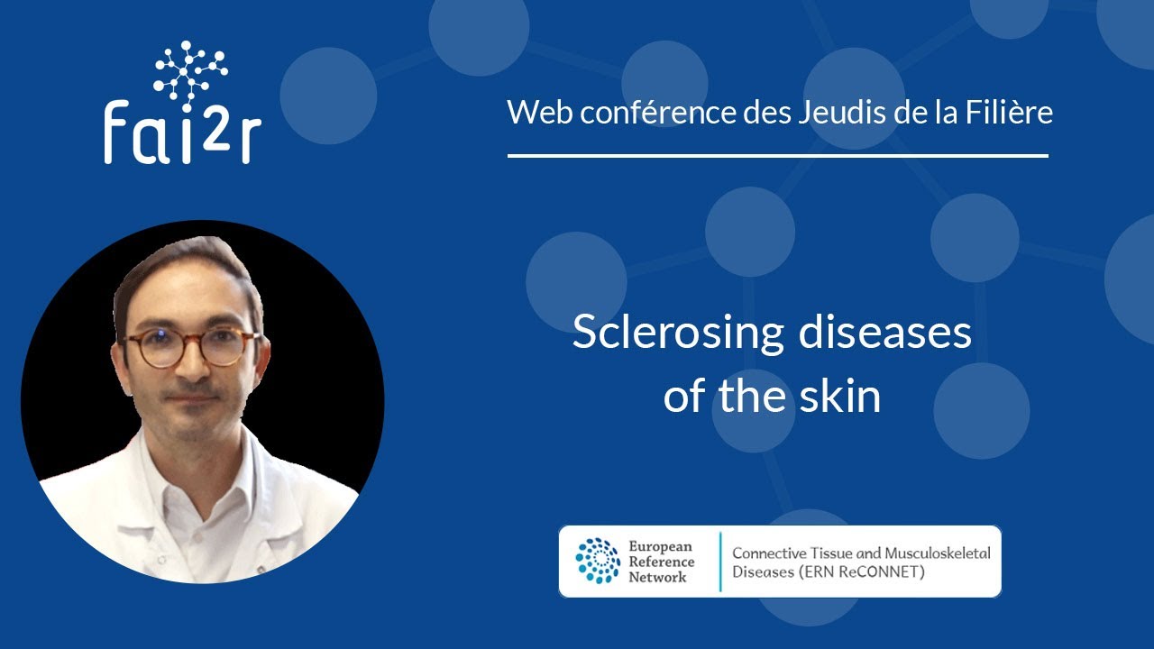 Sclerosing diseases of the skin