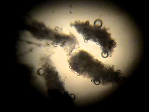 Morgellons Parasite Nano Bug Insect Peroxide Treatment and ...