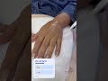 Hand rejuvenate with peeling #asmr #viral #shortvideo #skincare #handrejuvenation #drhanibeauty