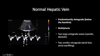 Doppler Ultrasound Part 2 - Spectral Waveforms from Head to Toe (Normal and Abnormal)