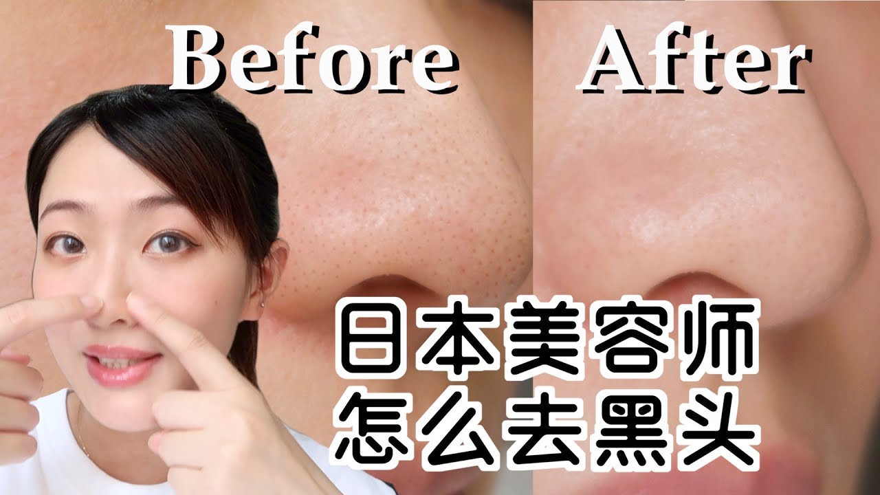 6分鐘告別草莓鼻日本美容師教你正确去黑頭 Youtube 6分鐘告別草莓鼻日本美容師教你正确去黑頭 Youtube