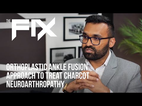 The FIX with Dr. S. Patel - Orthoplastic Ankle Fusion Approach to Treat Charcot Neuroarthropathy - video from Orthofix
