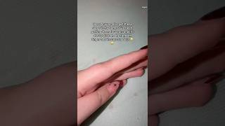 Does anyone else get these itch bumps? 😭#help #nails #nailtech #relatable