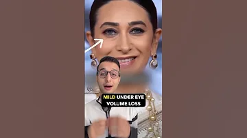 How To Get Rid Of Under Eye Bags Puffiness Dark Circles Fast Dr Sarin 