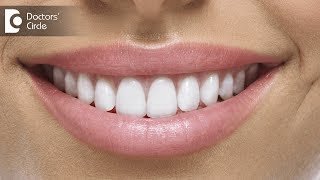 Can Porcelain Veneers stain over time? - Dr. Sangeeta Honnur