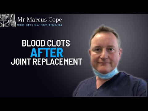 Blood clots after joint replacement