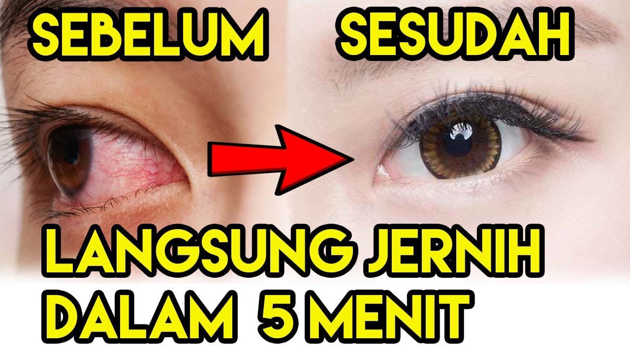 Cara Alami Menjernihkan Mata YouTube