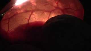 Candling Ball Python Eggs Wealth